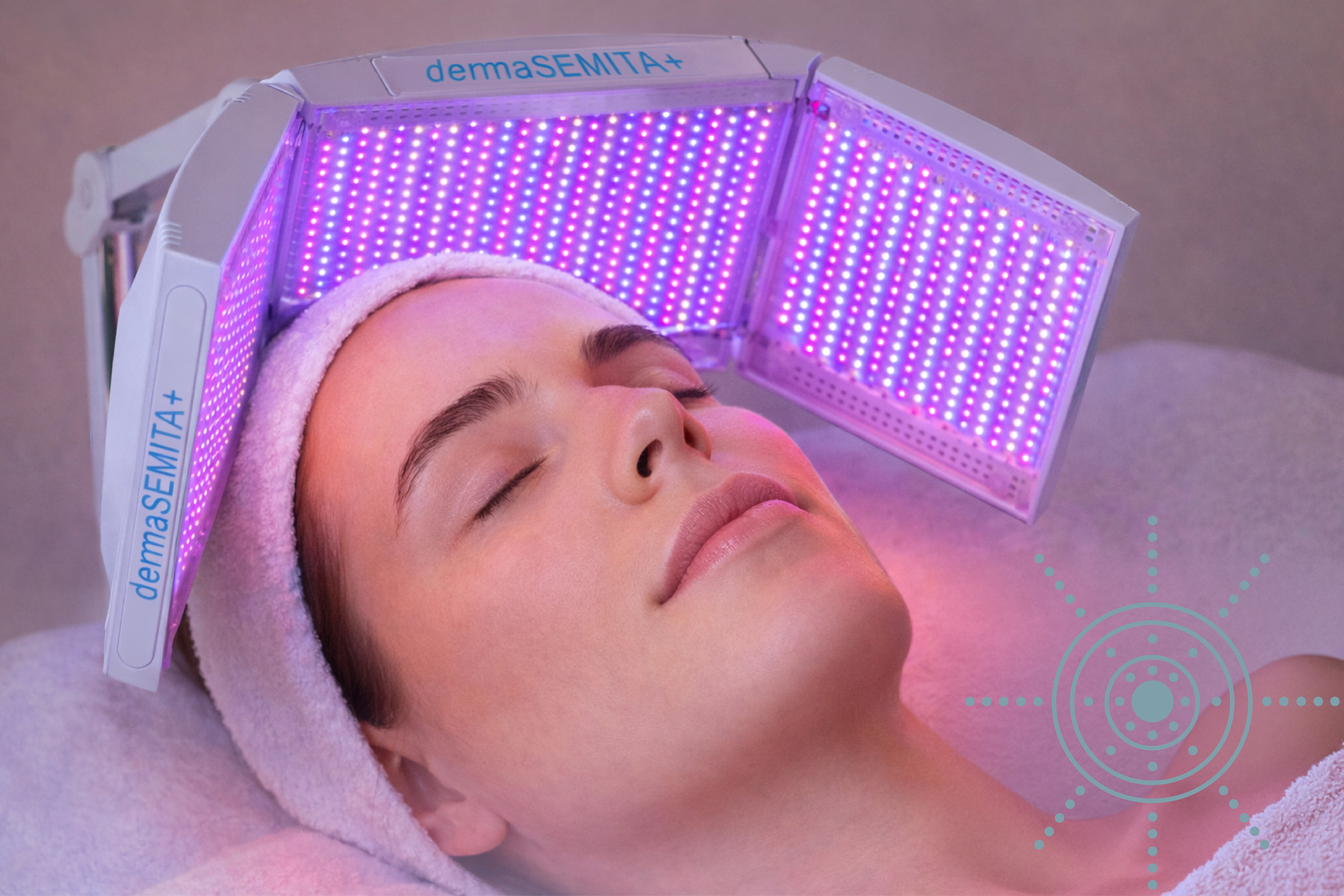 Microdermabrasion treatment